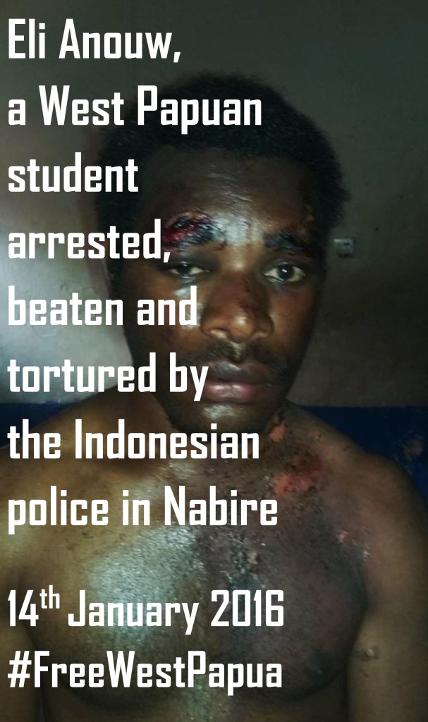 West Papuan youth tortured by Indonesian police in Nabire-page-001