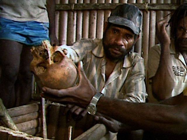 A West Papuan villager shows the skull of a West Papuan person shot dead by the Indonesian military.