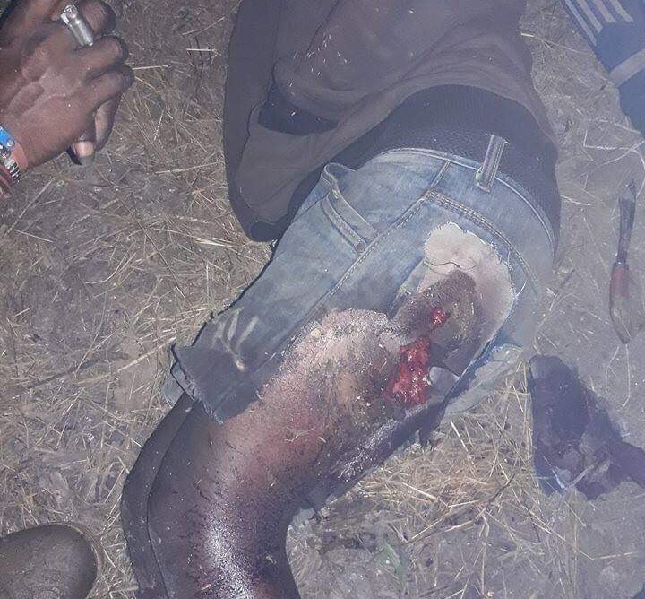 A villager wounded in the Indonesian attack in the West Papua central highlands.